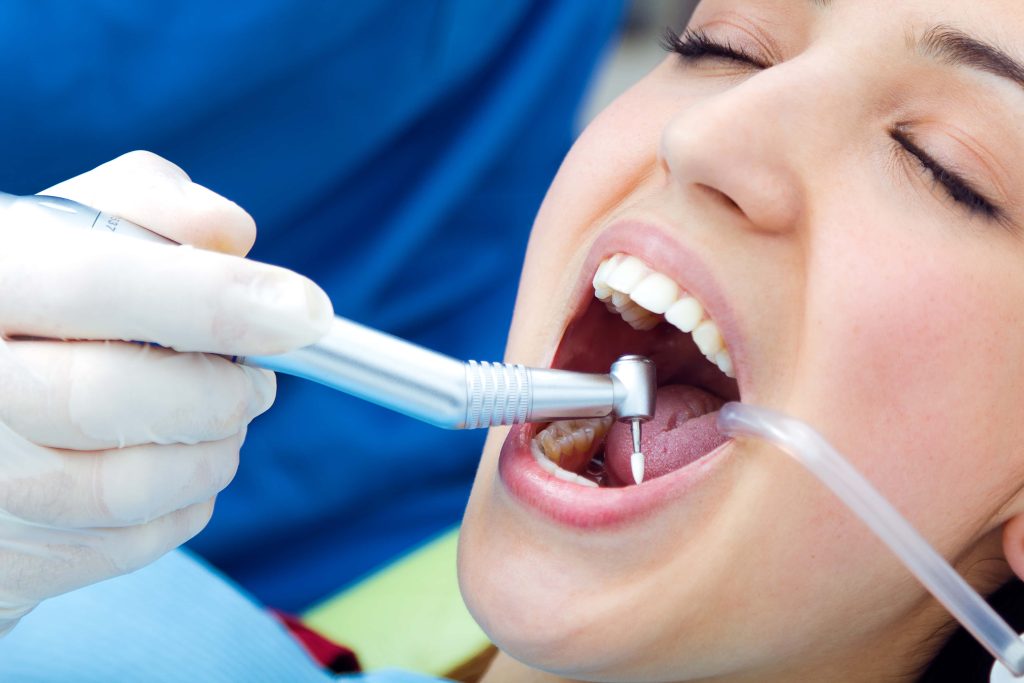 Dentist performing root canal on molar tooth, using drill and suction to remove infection safely.